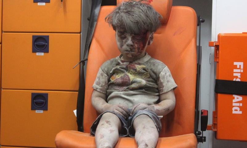 Omran Daqneesh (3). Photo by Mahmud Rslan, Anadolu Agency. Used without permission.